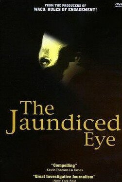 The Jaundiced Eye