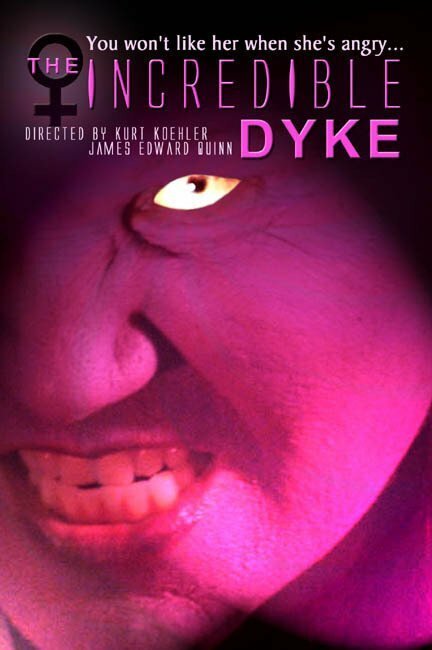 The Incredible Dyke